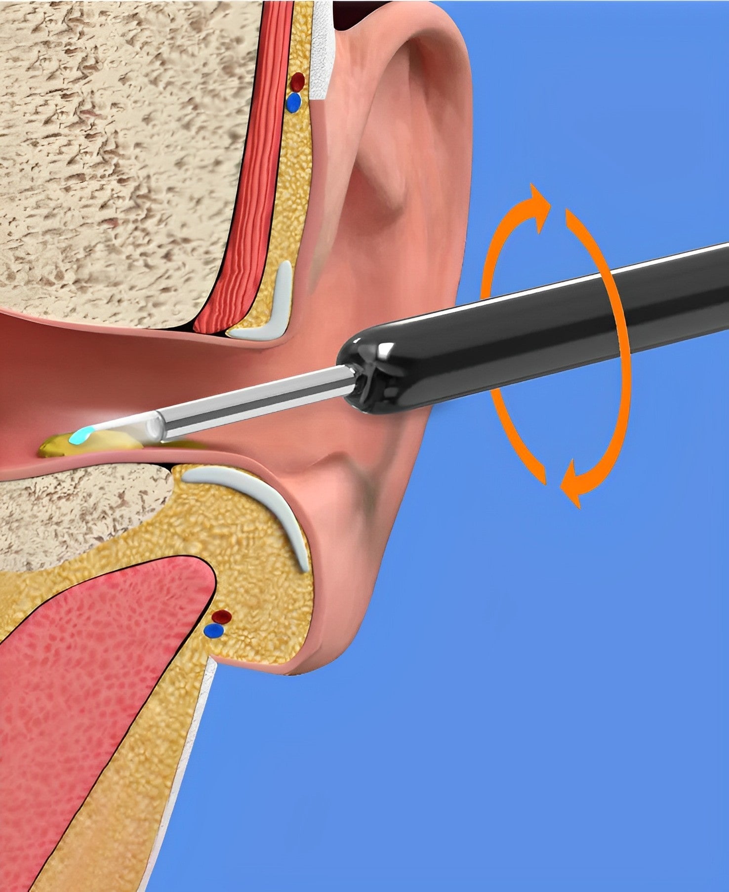 Raxiva-earbit 3000 ear cleaning tool with camera